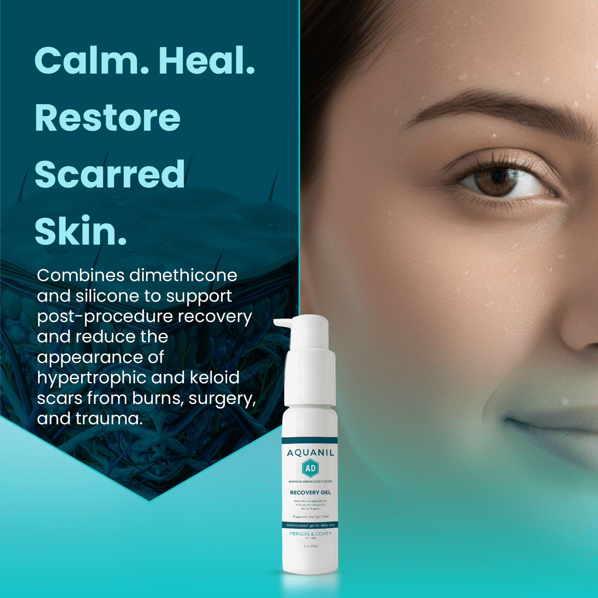 Aquanil AD Recovery Gel Keloid Bump Care with Hypochlorous Acid, 1 oz
